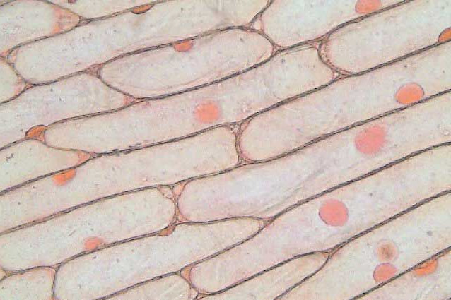 cellules-pelure-oignon.jpg